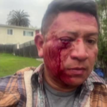 Inglewood man beaten, called racial slurs in unprovoked attack outside his home [GRAPHIC]