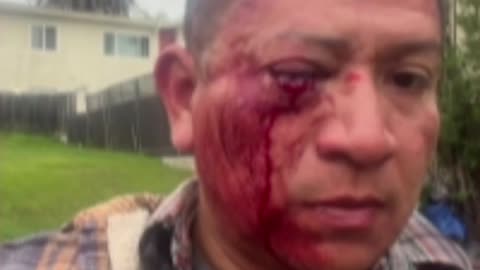 Inglewood man beaten, called racial slurs in unprovoked attack outside his home [GRAPHIC]