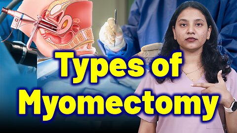 Types of Fibroid Surgery Explained: Laparoscopy, Hysteroscopy ,Abdominal surgery. | Treatment & Cure