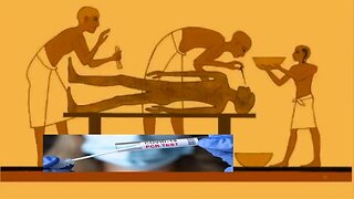 The Smoking Gun PCR Nasal Test is a vaccine US Patents = Mark of the Beast in the forehead