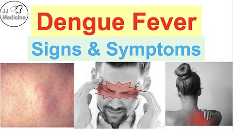 Dengue Fever Signs & Symptoms (Strange Skin Finding, “Breakbone” Aches, Very High Fever, & Others)