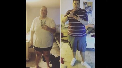 MBP 20180406 Why I had Bariatric Surgery...Twice!!!