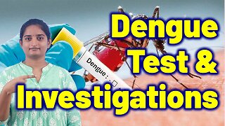 Tests and Investigations for Dengue | Homeopathy, Medicine Treatment & Cure Surgery