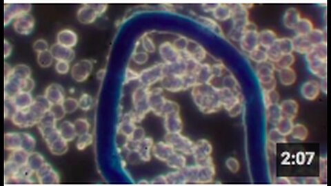 "New Phenomenon Observed in Injected Blood, Reports Indicate"