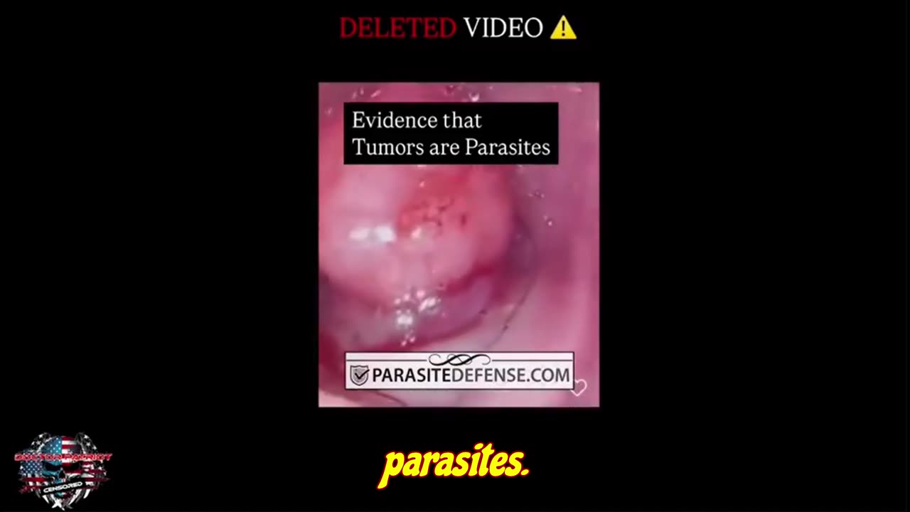Evidence That Tumors aka Cancer Are Parasites! .......
