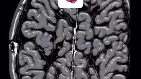 Weird noise typical only 11 seconds didn't help me