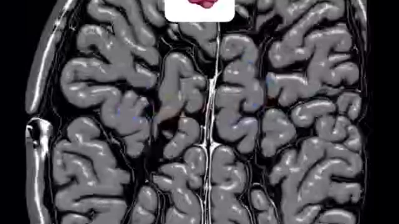 Weird noise typical only 11 seconds didn't help me