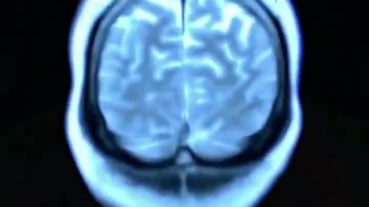Groundbreaking Alzheimer's Cure...