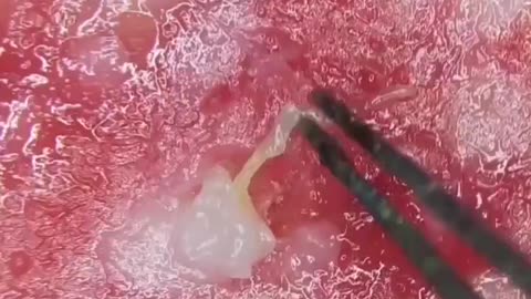 Nobodies ever really paid much attention to Parasites until now.