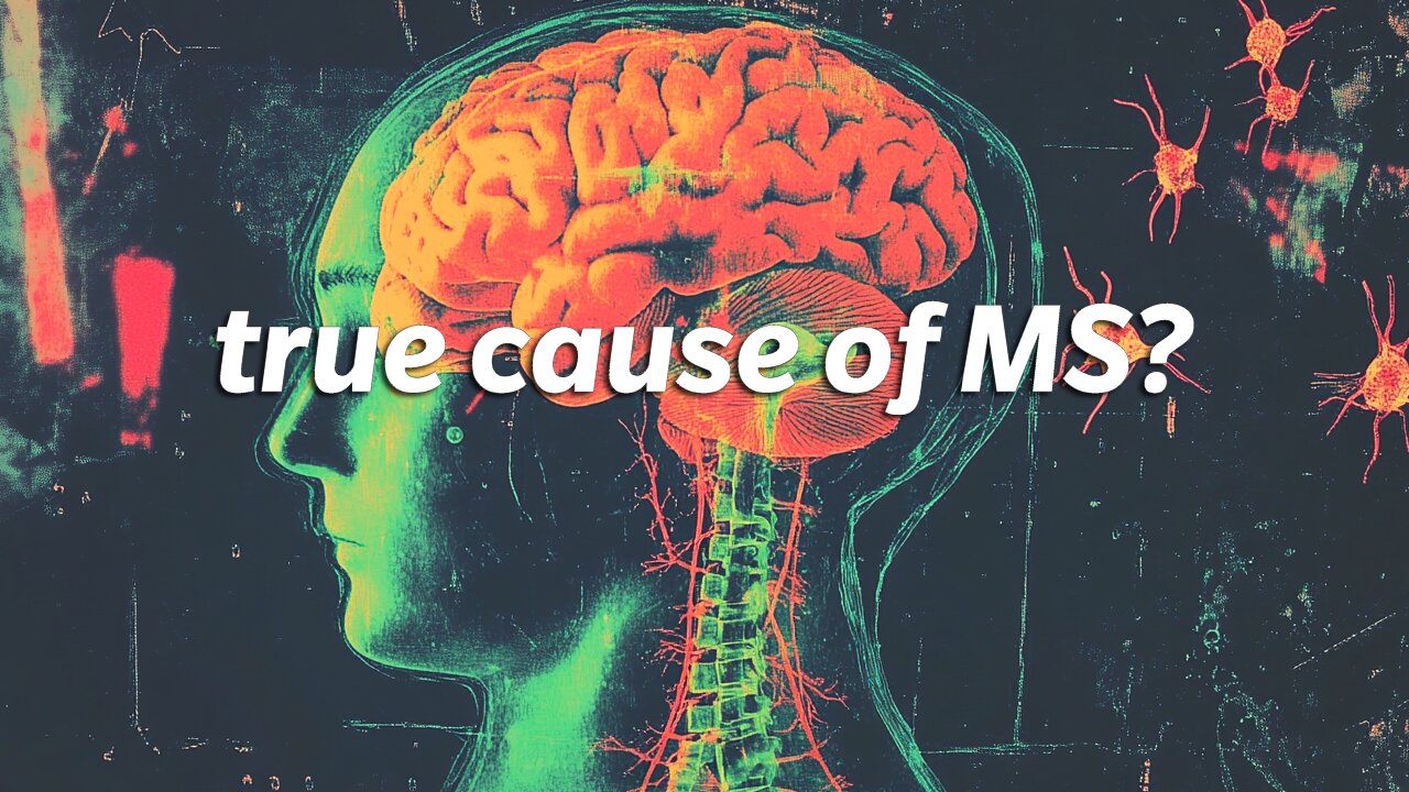 Is Multiple Sclerosis a Parasitic Disease? Shocking New Research Reveals Hidden Culprit
