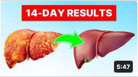 "Liver Health: Exploring Natural Remedies"