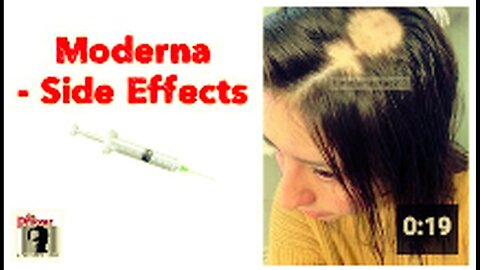 "Side Effects of Moderna COVID-19 Vaccine"
