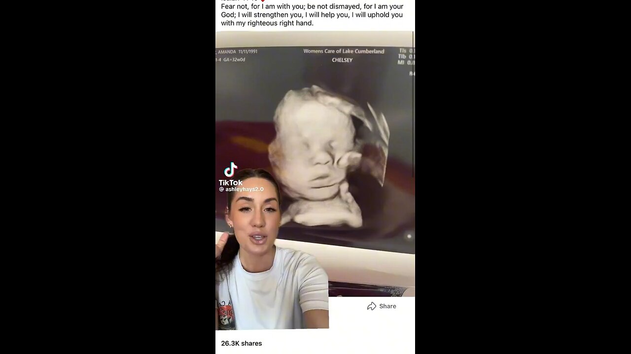 Amazing What This Ultrasound Captured😇😍