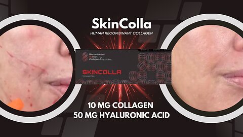 SkinColla Collagen - I'm Loving my Results!