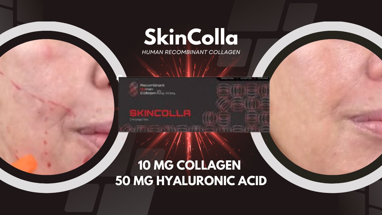 SkinColla Collagen - I'm Loving my Results!