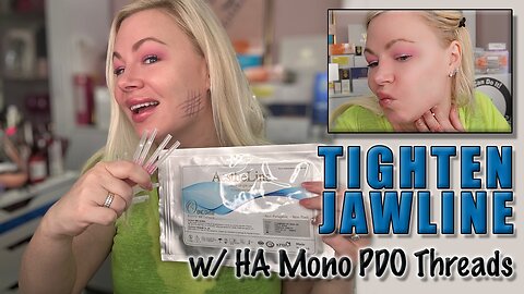 Tighten Jawline with HA Mono Threads! AceCosm.com and code Jessica10 saves you Money