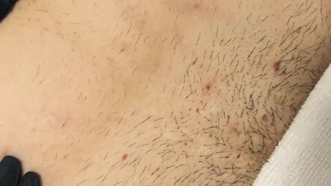 Brazilian Waxing with Sexy Smooth Coral Crush & Coconut Pearl Essence | @luminous.by.lex