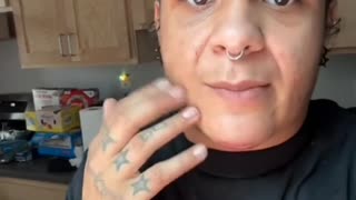 Corbyn explains the mechanics of her facial masculinization surgery