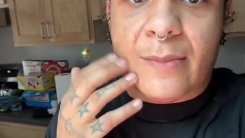 Corbyn explains the mechanics of her facial masculinization surgery