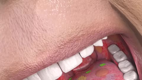 What_Happens_When_You_Eat_Poison_Ivy_
