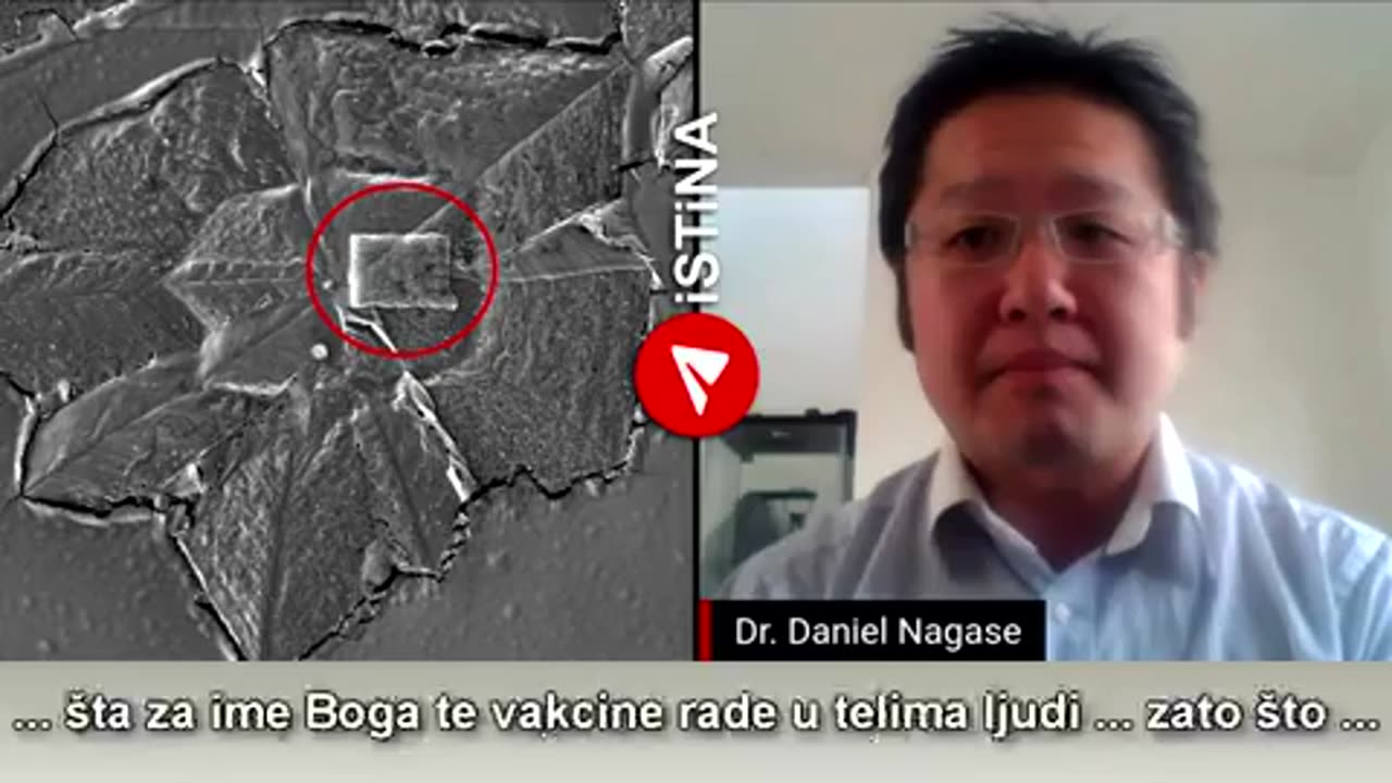 “世界揭露4_14”加拿大醫學專家Dr.Nagase長瀬 博士公開他的研究報告，在mRNA類新冠疫苗（輝瑞和莫德納）疫苗瓶內容物中，發現“芯片、納米技術藍天線接收器、腦機接口的大腦增強器”…