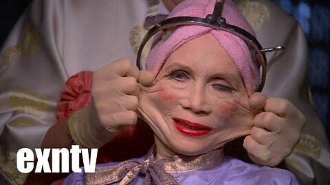 Vanity & Sanity, The End Of Filler & Botox! Women Agree To Get Old And Die! Wrinkles Are In Again!.
