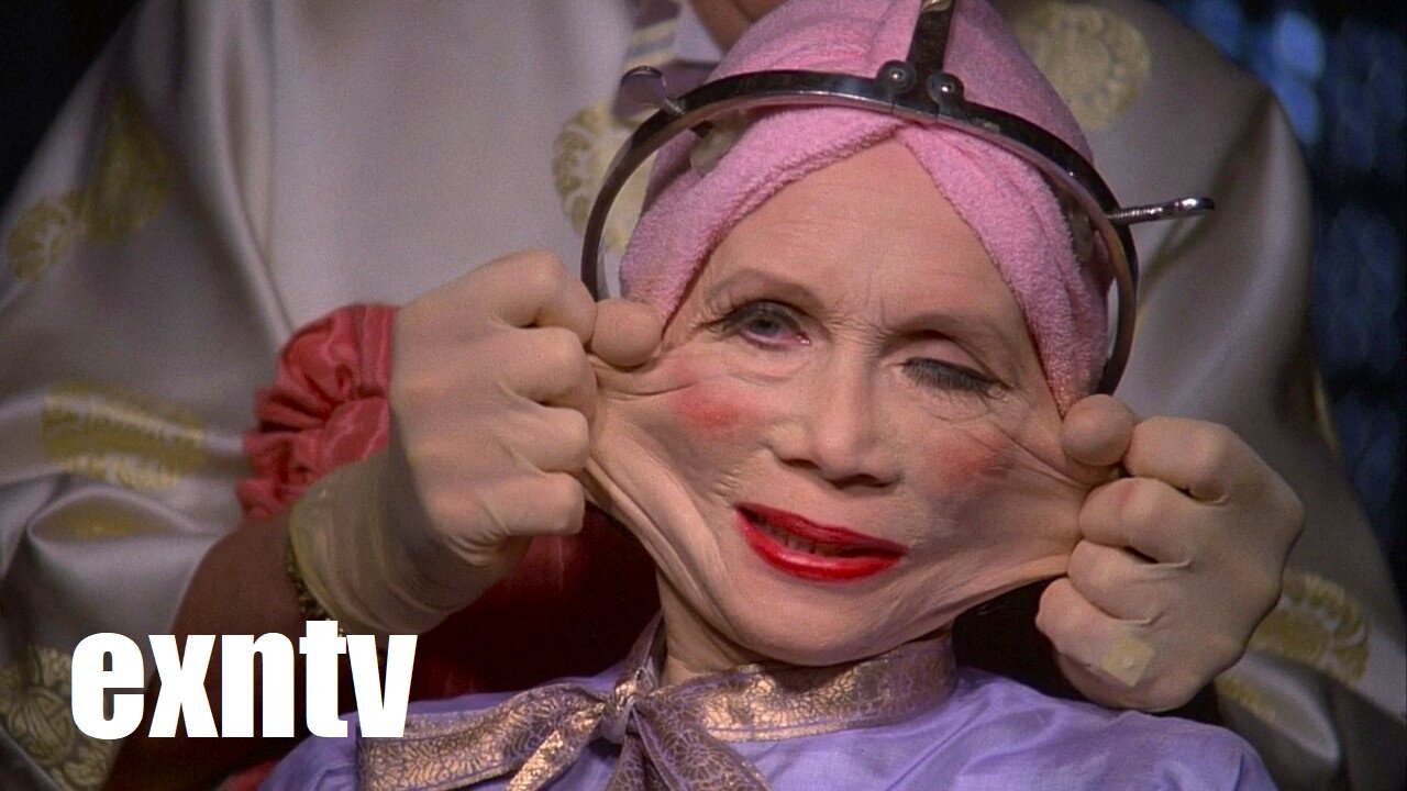 Vanity & Sanity, The End Of Filler & Botox! Women Agree To Get Old And Die! Wrinkles Are In Again!.