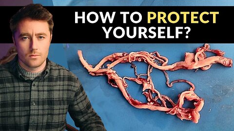 Amyloid Clots Found in EVERY SINGLE PERSON Who Got Jabbed: Brand New Study | EONutrition