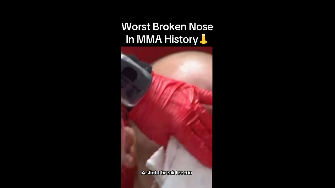 Worst Broken Nose In MMA History — Mike Perry VS Vicente Luque @ UFC Fight Night 156❗️💥
