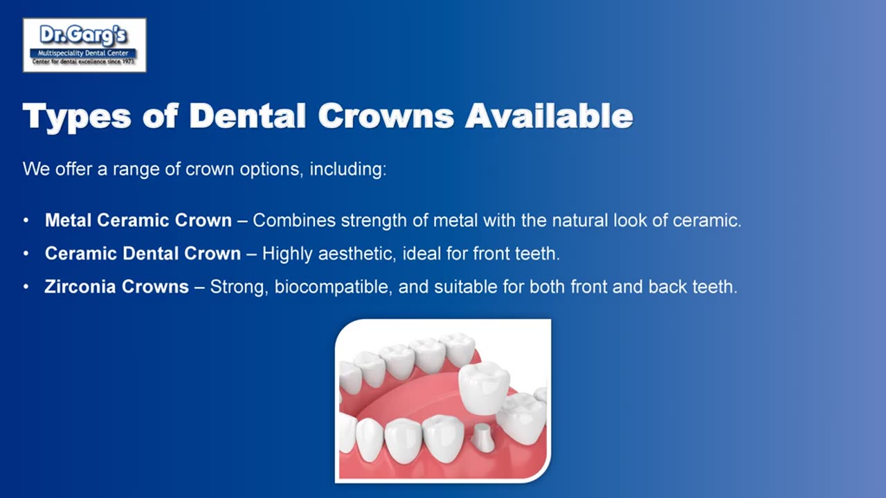 Restore Your Smile with Advanced Dental Crowns at Dr. Garg’s Dental Center