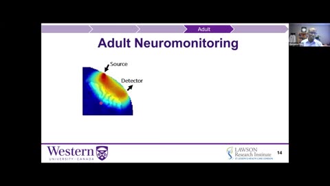 Quantum Sensor forNoninvasive Monitoring of Cerebral Oxygen Metabolism IEEE SENSORS