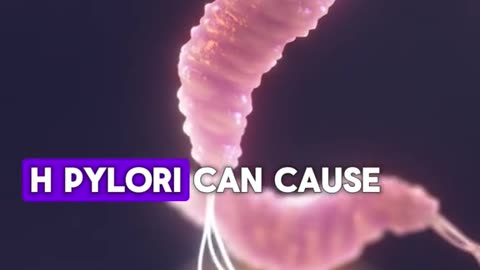 Symptoms of Helicobacter pylori , H pylori infection of the stomach