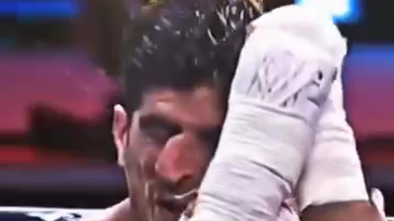 Broke His Nose