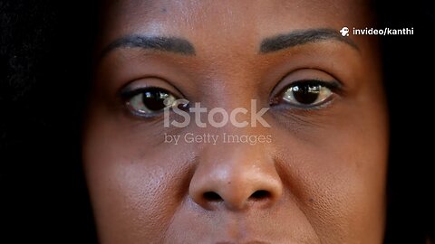 Longevity - heal your beutiful skin wrinkles less by visualization