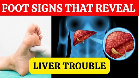 Your Feet Can Expose Liver Problems—Here's What to Watch For |HR14