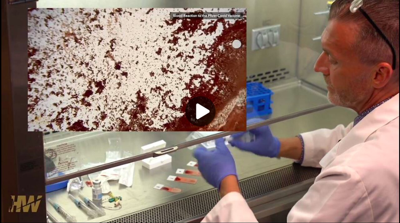 "Unveiling the True Contents of COVID Vaccines: An Insight from a Pathologist"