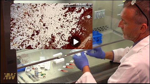 "Unveiling the True Contents of COVID Vaccines: An Insight from a Pathologist"