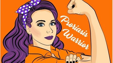 Dandruff scratching with nails #dandruff #psoriasis #asmr