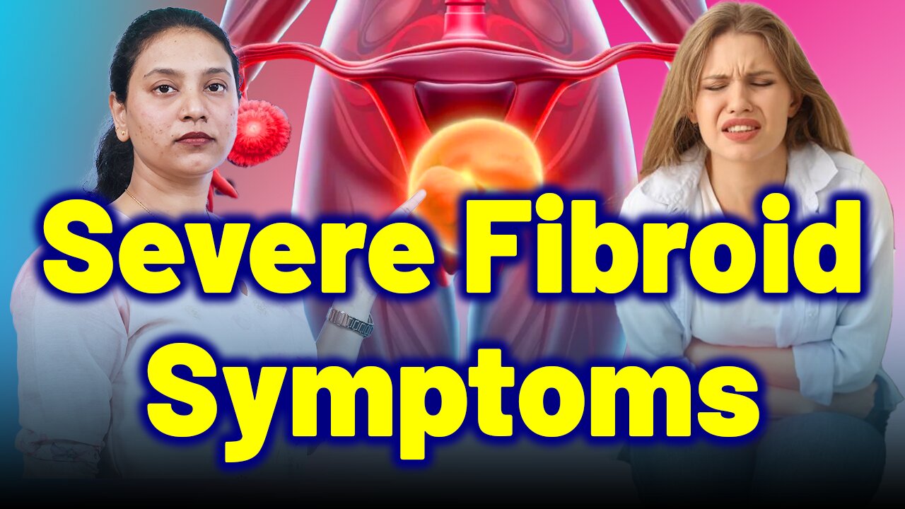 Shocking Signs of Fibroids Most Women Ignore!| Treatment Cure Medicine Surgery | Gynaecology