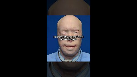 THIS MAN LOST HIS FACE🤯😱