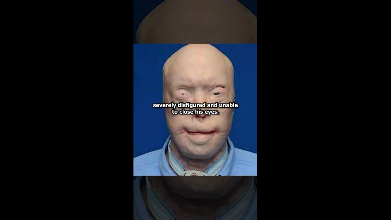 THIS MAN LOST HIS FACE🤯😱