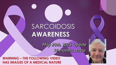 My Sarcoidosis Journey - May 28, 2025 Update