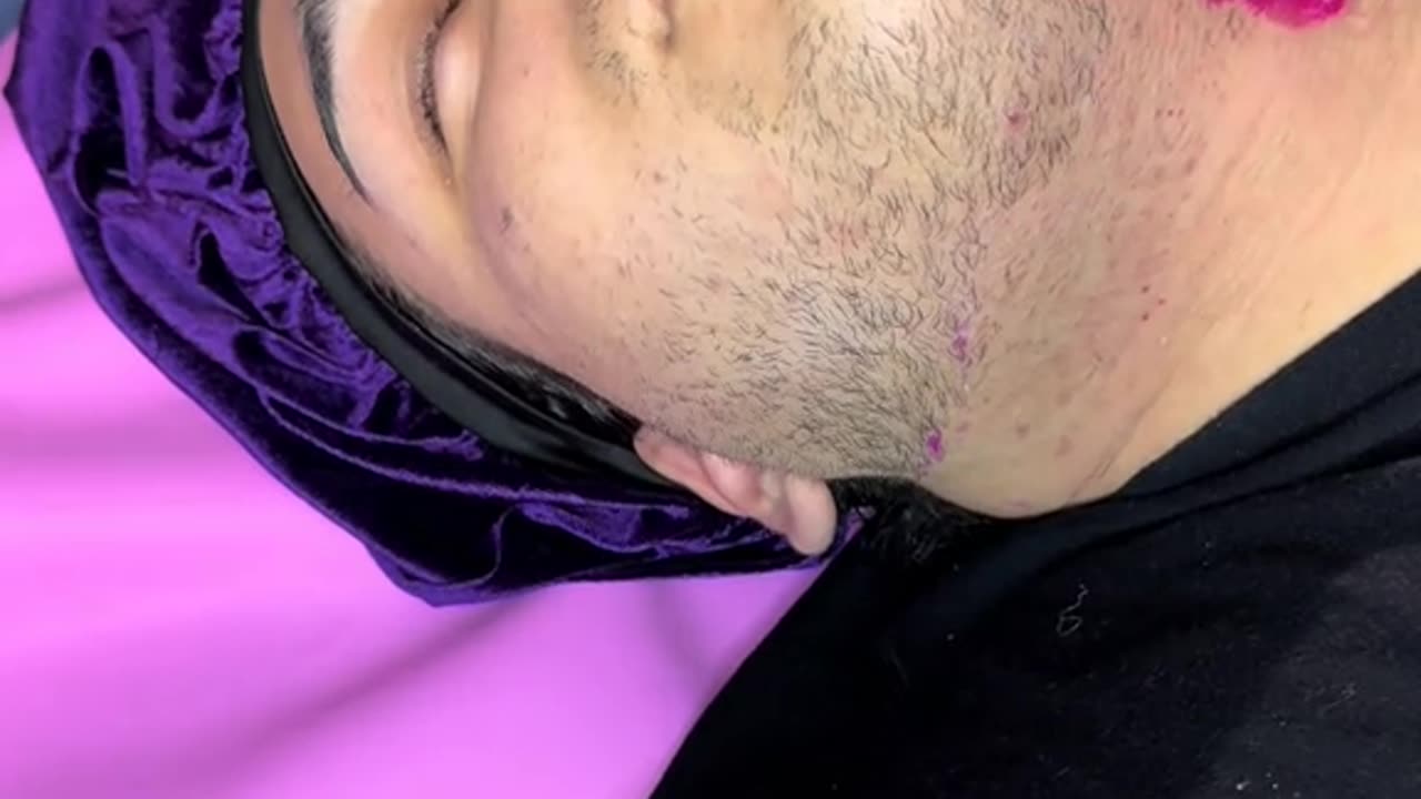 Full Male Beard Waxing Using Tickled Pink Hard Wax | Part 1 | @Estheticsbymaritza