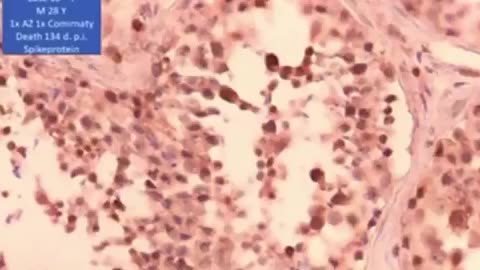 Claims About COVID Vaccine Effects on Male Reproductive Cells Stir Online Backlash