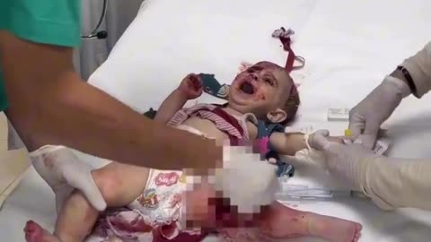 This is not war this is genocide