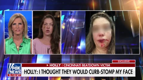 Holly, the victim of the brutal Cincinnati attack, reveals the lack of police action....