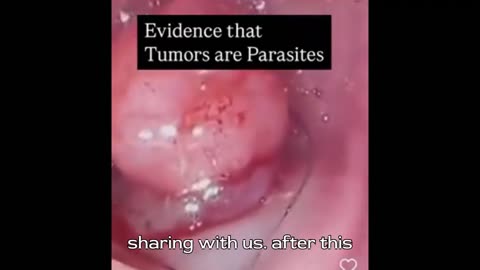 Tumors are Parasites 🪱🪱🪱