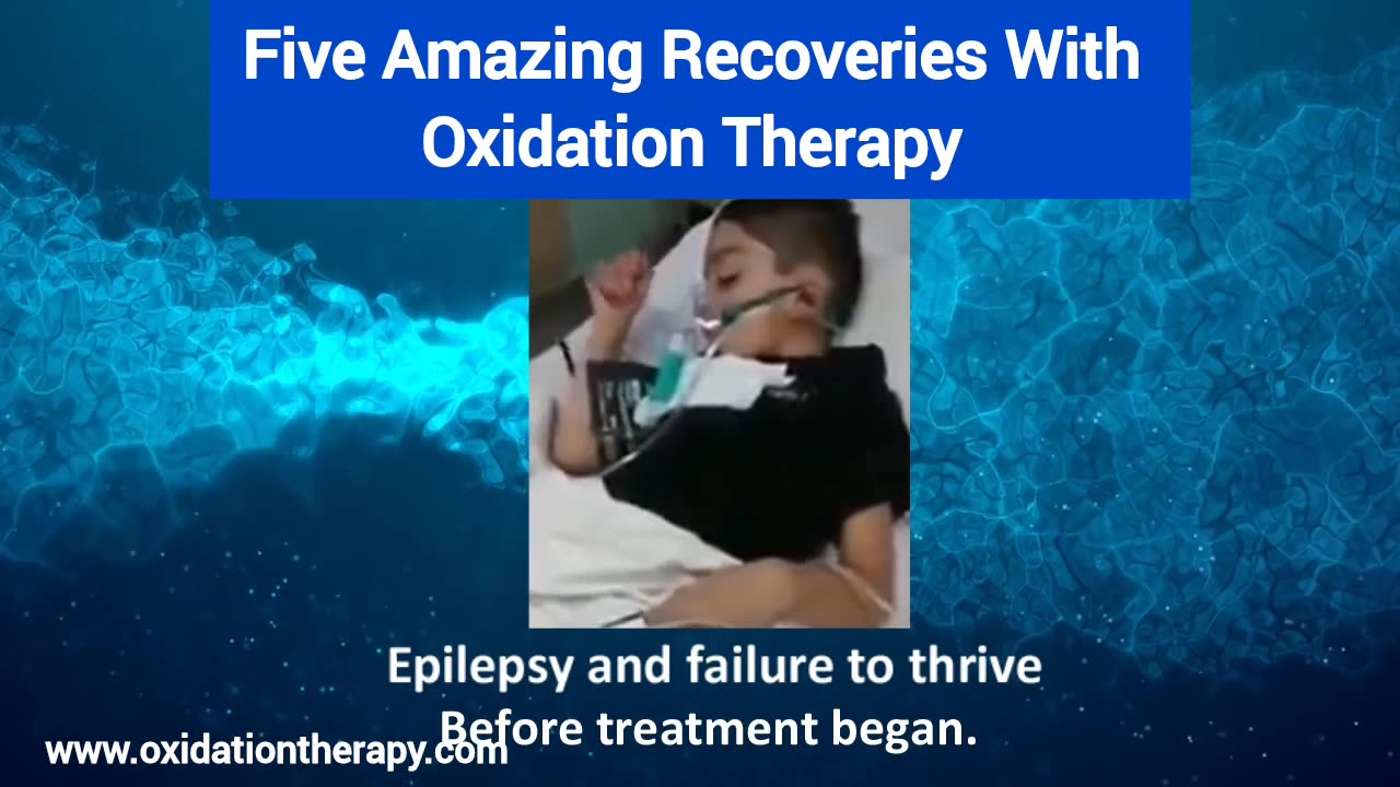 Five Amazing Recoveries With Oxidation Therapy