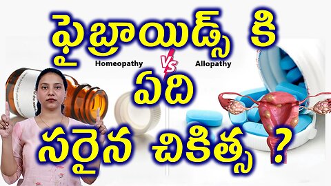 ఫైబ్రాయిడ్స్ సరైన చికిత్స Best Fibroid Treatment Homeopathy or Myomectomy, Hysterectomy Surgery Cure