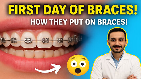The most beautiful endings to the orthodontic stage